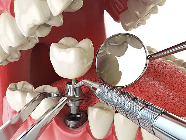 Best Emergency Dental Care for Sports Injuries in Plainfield Village, CT